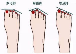 天生不适合跑步和跳舞的脚型_刘氏家族